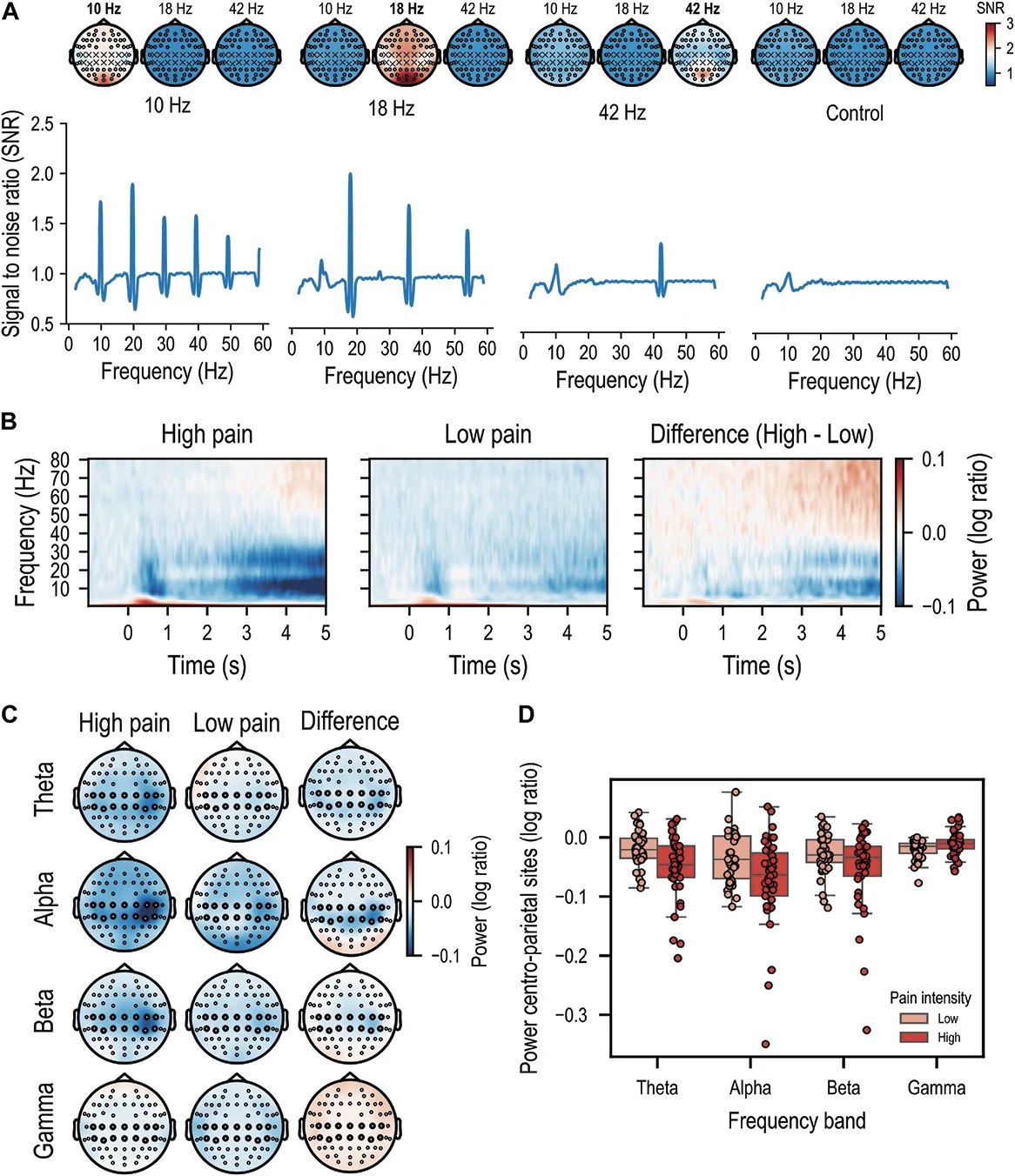 Figure 2, No effect of rhythmic visual stimulation on experimental pain perception