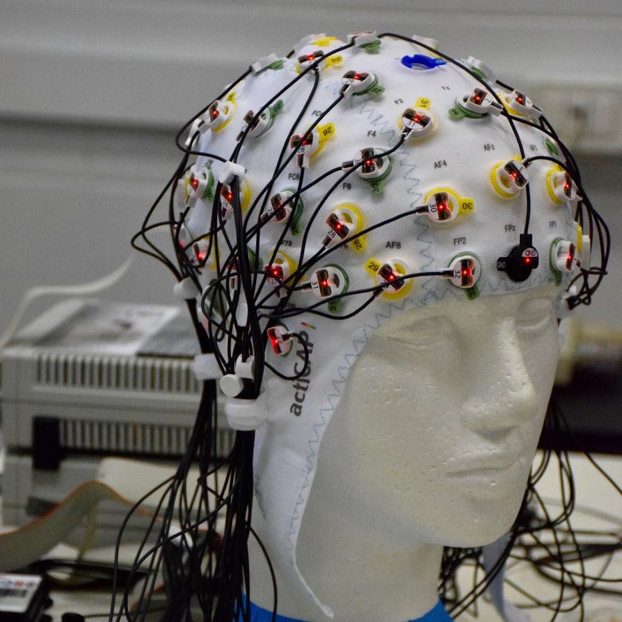 Electroencephalography (EEG)